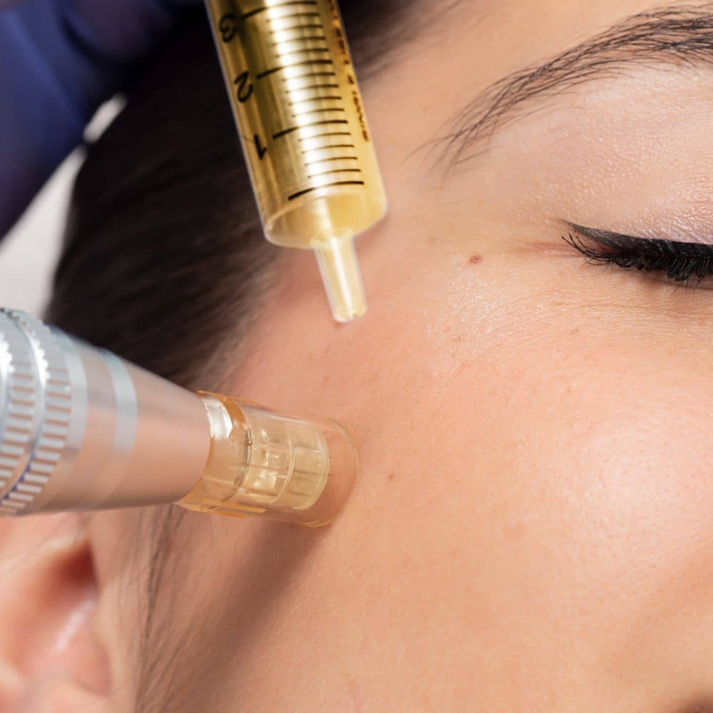 Botox Nürnberg: Ihr Weg zu einem jüngeren und frischeren Aussehen